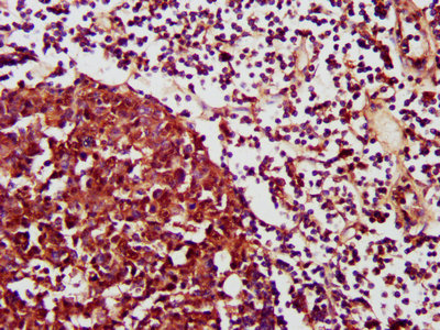 IHC image of CXCR3 Antibody diluted at 1:1200 and staining in paraffin-embedded human lymph node tissue performed on a Leica BondTM system. After dewaxing and hydration, antigen retrieval was mediated by high pressure in a citrate buffer (pH 6.0). Section was blocked with 10% normal goat serum 30min at RT. Then primary antibody (1% BSA) was incubated at 4°C overnight. The primary is detected by a biotinylated secondary antibody and visualized using an HRP conjugated SP system.Rabbit anti-Human CXCR3 Polyclonal Antibody