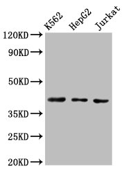 Western Blot | Positive WB detected in: K562 whole cell lysate, HepG2 whole cell lysate, Jurkat whole cell lysate | All lanes: CXCR3 antibody at 3μg/ml | Secondary | Goat polyclonal to rabbit IgG at 1/50000 dilution | Predicted band size: 41, 46, 29 kDa | Observed band size: 41 kDaRabbit anti-Human CXCR3 Polyclonal Antibody
