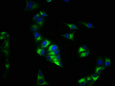 Immunofluorescence staining of Hela cells with the antibody at 1:200, counter-stained with DAPI. The cells were fixed in 4% formaldehyde, permeabilized using 0.2% Triton X-100 and blocked in 10% normal Goat Serum. The cells were then incubated with the antibody overnight at 4°C. The secondary antibody was Alexa Fluor 488-congugated AffiniPure Goat Anti-Rabbit IgG(H+L).Rabbit anti-Human CXCR4 Polyclonal Antibody