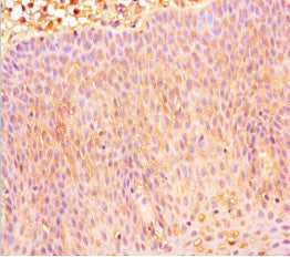 Immunohistochemistry of paraffin-embedded human tonsil tissue using CXCR4 Antibody at dilution of 1:100Rabbit anti-Human CXCR4 Polyclonal Antibody