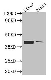 Western Blot  | Positive WB detected in: Mouse liver tissue, Mouse brain tissue  | All lanes: CXCR4 antibody at 2.6µg/ml  | Secondary  | Goat polyclonal to rabbit IgG at 1/50000 dilution  | Predicted band size: 40, 41 kDa  | Observed band size: 40 kDaRabbit anti-Human CXCR4 Polyclonal Antibody
