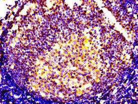Immunohistochemistry of paraffin-embedded human lymph node tissue using CXCR5 Antibody at dilution of 1:100Rabbit anti-Human CXCR5 Polyclonal Antibody