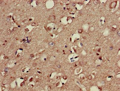 Immunohistochemistry of paraffin-embedded human brain tissue using AP2M1 Antibody at dilution of 1:100Rabbit anti-Human AP2M1 Polyclonal Antibody