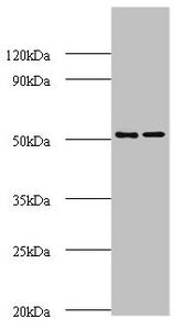 Western blot | All lanes: AP-2 complex subunit mu polyclonal Antibody at 2μg/ml | Lane 1: Mouse brain tissue | Lane 2: Rat brain tissue | Secondary | Goat polyclonal to rabbit IgG at 1/10000 dilution | Predicted band size: 50 kDa | Observed band size: 50 kDaRabbit anti-Human AP2M1 Polyclonal Antibody