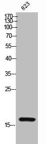 Western Blot analysis of 823 cells using CD235a Polyclonal AntibodyRabbit anti-Human GYPA Polyclonal Antibody