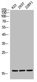 Western Blot analysis of 823 293T 22RV cells using CD235a Polyclonal AntibodyRabbit anti-Human GYPA Polyclonal Antibody