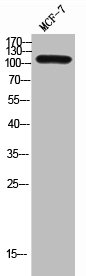 Western Blot analysis of MCF-7 cells using CD249 Polyclonal AntibodyRabbit anti-Human ENPEP Polyclonal Antibody