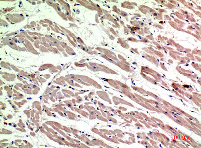 Immunohistochemical analysis of paraffin-embedded human-heart, antibody was diluted at 1:200