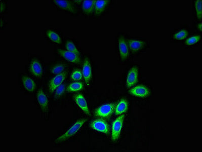 Immunofluorescent analysis of HepG2 cells using CYB5B Antibody at dilution of 1:100 and Alexa Fluor 488-congugated AffiniPure Goat Anti-Rabbit IgG(H+L)Rabbit anti-Human CYB5B Polyclonal Antibody