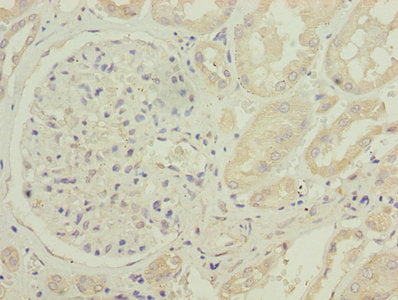 Immunohistochemistry of paraffin-embedded human kidney tissue using CYB5B Antibody at dilution of 1:100Rabbit anti-Human CYB5B Polyclonal Antibody