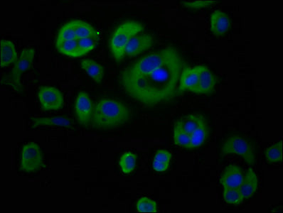 Immunofluorescence staining of MCF-7 cells with CYBA Antibody at 1:66, counter-stained with DAPI. The cells were fixed in 4% formaldehyde, permeabilized using 0.2% Triton X-100 and blocked in 10% normal Goat Serum. The cells were then incubated with the antibody overnight at 4°C. The secondary antibody was Alexa Fluor 488-congugated AffiniPure Goat Anti-Rabbit IgG(H+L).Rabbit anti-Human CYBA Polyclonal Antibody