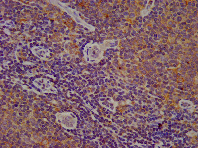 IHC image of the antibody diluted at 1:200 and staining in paraffin-embedded human lymph node tissue performed on a Leica BondTM system. After dewaxing and hydration, antigen retrieval was mediated by high pressure in a citrate buffer (pH 6.0). Section was blocked with 10% normal goat serum 30min at RT. Then primary antibody (1% BSA) was incubated at 4°C overnight. The primary is detected by a biotinylated secondary antibody and visualized using an HRP conjugated SP system.Rabbit anti-Human CYBA Polyclonal Antibody