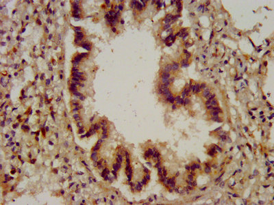 IHC image of CYBA Antibody diluted at 1:200 and staining in paraffin-embedded human lung tissue performed on a Leica BondTM system. After dewaxing and hydration, antigen retrieval was mediated by high pressure in a citrate buffer (pH 6.0). Section was blocked with 10% normal goat serum 30min at RT. Then primary antibody (1% BSA) was incubated at 4°C overnight. The primary is detected by a biotinylated secondary antibody and visualized using an HRP conjugated SP system.Rabbit anti-Human CYBA Polyclonal Antibody