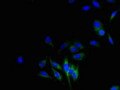 Immunofluorescent analysis of Hela cells using CYBB Antibody at dilution of 1:100 and Alexa Fluor 488-congugated AffiniPure Goat Anti-Rabbit IgG(H+L)Rabbit anti-Human CYBB Polyclonal Antibody