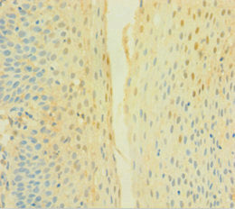 Immunohistochemistry of paraffin-embedded human tonsil tissue using the antibody at dilution of 1:100Rabbit anti-Human CYBB Polyclonal Antibody