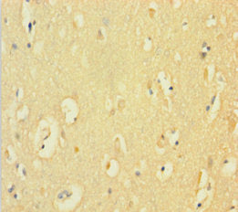 Immunohistochemistry of paraffin-embedded human brain tissue using CYBB Antibody at dilution of 1:100Rabbit anti-Human CYBB Polyclonal Antibody