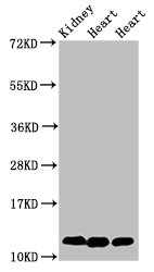 Western Blot  | Positive WB detected in: Rat kidney tissue, Rat heart tissue, Mouse heart tissue  | All lanes: CYCS antibody at 2µg/ml  | Secondary  | Goat polyclonal to rabbit IgG at 1/50000 dilution  | Predicted band size: 12 kDa  | Observed band size: 12 kDaRabbit anti-Human CYCS Polyclonal Antibody