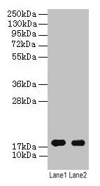 Western blot  | All lanes: ATP5F1D antibody at 2µg/ml  | Lane 1: EC109 whole cell lysate  | Lane 2: 293T whole cell lysate  | Secondary  | Goat polyclonal to rabbit IgG at 1/15000 dilution  | Predicted band size: 18 kDa  | Observed band size: 18 kDa