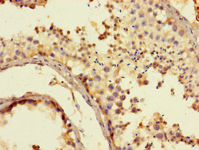Immunohistochemistry of paraffin-embedded human testis tissue using CYP17A1 Antibody at dilution of 1:100Rabbit anti-Human CYP17A1 Polyclonal Antibody