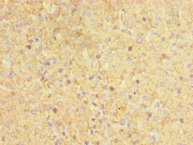 Immunohistochemistry of paraffin-embedded human adrenal gland tissue using CYP17A1 Antibody at dilution of 1:100Rabbit anti-Human CYP17A1 Polyclonal Antibody