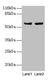 Western blot  | All lanes: CYP17A1 antibody at 2µg/ml  | Lane 1: Hela whole cell lysate  | Lane 2: A549 whole cell lysate  | Secondary  | Goat polyclonal to rabbit IgG at 1/10000 dilution  | Predicted band size: 58 kDa  | Observed band size: 58 kDaRabbit anti-Human CYP17A1 Polyclonal Antibody