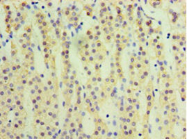 Immunohistochemistry of paraffin-embedded human adrenal gland tissue using CYP17A1 Antibody at dilution of 1:100Rabbit anti-Human CYP17A1 Polyclonal Antibody