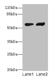 Western blot  | All lanes: CYP17A1 antibody at 12µg/ml  | Lane 1: Hela whole cell lysate  | Lane 2: A549 whole cell lysate  | Secondary  | Goat polyclonal to rabbit IgG at 1/10000 dilution  | Predicted band size: 58 kDa  | Observed band size: 58 kDaRabbit anti-Human CYP17A1 Polyclonal Antibody