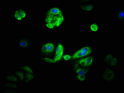 Immunofluorescence staining of HepG2 with CYP21A2 Antibody at 1:33, counter-stained with DAPI. The cells were fixed in 4% formaldehyde, permeabilized using 0.2% Triton X-100 and blocked in 10% normal Goat Serum. The cells were then incubated with the antibody overnight at 4°C. The secondary antibody was Alexa Fluor 488-congugated AffiniPure Goat Anti-Rabbit IgG(H+L).Rabbit anti-Human CYP21A2 Polyclonal Antibody