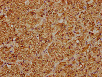 IHC image of CYP21A2 Antibody diluted at 1:100 and staining in paraffin-embedded human adrenal gland tissue performed on a Leica BondTM system. After dewaxing and hydration, antigen retrieval was mediated by high pressure in a citrate buffer (pH 6.0). Section was blocked with 10% normal goat serum 30min at RT. Then primary antibody (1% BSA) was incubated at 4°C overnight. The primary is detected by a biotinylated secondary antibody and visualized using an HRP conjugated SP system.Rabbit anti-Human CYP21A2 Polyclonal Antibody