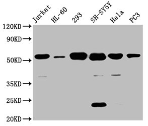 Western Blot  | Positive WB detected in: Jurkat whole cell lysate, HL60 whole cell lysate, 293 whole cell lysate, SH-SY5Y whole cell lysate, Hela whole cell lysate, PC-3 whole cell lysate  | All lanes: CYP21A2 antibody at 8µg/ml  | Secondary  | Goat polyclonal to rabbit IgG at 1/50000 dilution  | Predicted band size: 56, 53 kDa  | Observed band size: 56 kDaRabbit anti-Human CYP21A2 Polyclonal Antibody