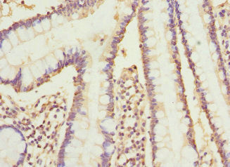 Immunohistochemistry of paraffin-embedded human small intestine tissue using CYP2C18 Antibody at dilution of 1:100Rabbit anti-Human CYP2C18 Polyclonal Antibody