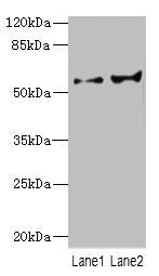 Western blot | All lanes: CYP2C18 antibody at 5.98μg/ml | Lane 1: HL60 whole cell lysate | Lane 2: 293T whole cell lysate | Secondary | Goat polyclonal to rabbit IgG at 1/10000 dilution | Predicted band size: 56, 49 kDa | Observed band size: 56 kDaRabbit anti-Human CYP2C18 Polyclonal Antibody