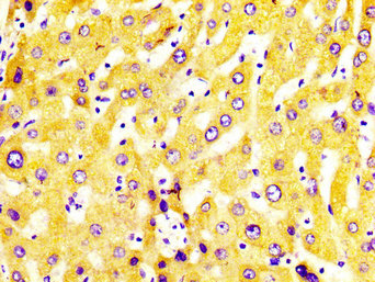 IHC image of CYP2C19 Antibody diluted at 1:400 and staining in paraffin-embedded human liver tissue performed on a Leica BondTM system. After dewaxing and hydration, antigen retrieval was mediated by high pressure in a citrate buffer (pH 6.0). Section was blocked with 10% normal goat serum 30min at RT. Then primary antibody (1% BSA) was incubated at 4°C overnight. The primary is detected by a biotinylated secondary antibody and visualized using an HRP conjugated SP system.Rabbit anti-Human CYP2C19 Polyclonal Antibody