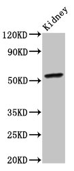 Western Blot | Positive WB detected in: Mouse kidney tissue | All lanes: CYP2C19 antibody at 4μg/ml | Secondary | Goat polyclonal to rabbit IgG at 1/50000 dilution | Predicted band size: 56 kDa | Observed band size: 56 kDaRabbit anti-Human CYP2C19 Polyclonal Antibody