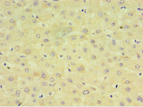 Immunohistochemistry of paraffin-embedded human liver tissue using CYP2J2 Antibody at dilution of 1:100Rabbit anti-Human CYP2J2 Polyclonal Antibody