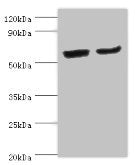 Western blot | All lanes: CYP2J2 antibody at 4μg/ml | Lane 1: Mouse skeletal muscle tissue | Lane 2: Rat liver tissue | Secondary | Goat polyclonal to rabbit IgG at 1/10000 dilution | Predicted band size: 58 kDa | Observed band size: 58 kDaRabbit anti-Human CYP2J2 Polyclonal Antibody