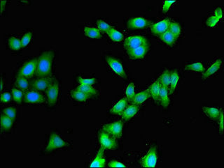Immunofluorescent analysis of HepG2 cells using CYP3A4 Antibody at dilution of 1:100 and Alexa Fluor 488-congugated AffiniPure Goat Anti-Rabbit IgG(H+L)Rabbit anti-Human CYP3A4 Polyclonal Antibody