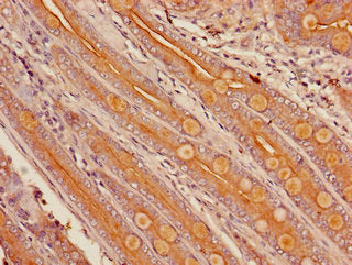 Immunohistochemistry of paraffin-embedded human small intestine tissue using the antibody at dilution of 1:100Rabbit anti-Human CYP3A4 Polyclonal Antibody