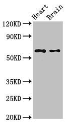 Western Blot | Positive WB detected in: Mouse heart tissue, Mouse brain tissue | All lanes: CYP3A4 antibody at 2.8μg/ml | Secondary | Goat polyclonal to rabbit IgG at 1/50000 dilution | Predicted band size: 58 kDa | Observed band size: 58 kDaRabbit anti-Human CYP3A4 Polyclonal Antibody