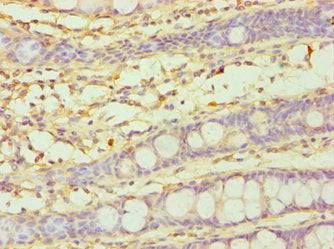 Immunohistochemistry of paraffin-embedded human colon tissue using CYP3A5 Antibody at dilution of 1:100Rabbit anti-Human CYP3A5 Polyclonal Antibody