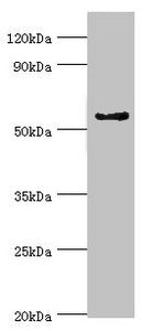 Western blot | All lanes: Cytochrome P450 3A5 antibody at 9μg/ml + Mouse liver tissue | Secondary | Goat polyclonal to rabbit IgG at 1/10000 dilution | Predicted band size: 58, 16 kDa | Observed band size: 58 kDaRabbit anti-Human CYP3A5 Polyclonal Antibody