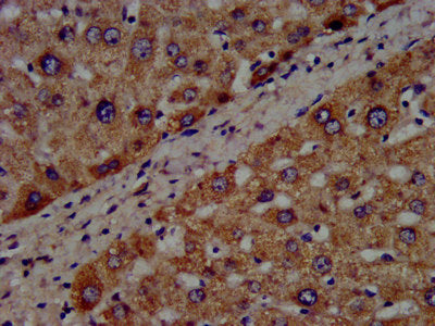 IHC image of CYP8B1 Antibody diluted at 1:300 and staining in paraffin-embedded human liver tissue performed on a Leica BondTM system. After dewaxing and hydration, antigen retrieval was mediated by high pressure in a citrate buffer (pH 6.0). Section was blocked with 10% normal goat serum 30min at RT. Then primary antibody (1% BSA) was incubated at 4°C overnight. The primary is detected by a biotinylated secondary antibody and visualized using an HRP conjugated SP system.Rabbit anti-Human CYP8B1 Polyclonal Antibody