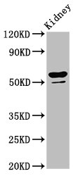 Western Blot | Positive WB detected in: Rat kidney tissue | All lanes: CYP8B1 antibody at 6.4μg/ml | Secondary | Goat polyclonal to rabbit IgG at 1/50000 dilution | Predicted band size: 59 kDa | Observed band size: 59 kDaRabbit anti-Human CYP8B1 Polyclonal Antibody