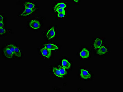 Immunofluorescent analysis of A375 cells using CYSLTR1 Antibody at dilution of 1:100 and Alexa Fluor 488-congugated AffiniPure Goat Anti-Rabbit IgG(H+L)Rabbit anti-Human CYSLTR1 Polyclonal Antibody