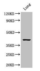 Western Blot | Positive WB detected in: Mouse lung tissue | All lanes: CYSLTR1 antibody at 3μg/ml | Secondary | Goat polyclonal to rabbit IgG at 1/50000 dilution | Predicted band size: 39 kDa | Observed band size: 39 kDaRabbit anti-Human CYSLTR1 Polyclonal Antibody