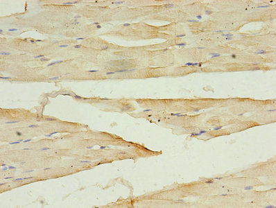 Immunohistochemistry of paraffin-embedded human skeletal muscle tissue using DAPK2 Antibody at dilution of 1:100Rabbit anti-Human DAPK2 Polyclonal Antibody