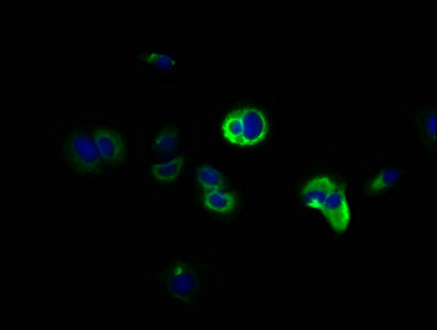 Immunofluorescence staining of MCF-7 cells with DCLK1 Antibody at 1:166, counter-stained with DAPI. The cells were fixed in 4% formaldehyde, permeabilized using 0.2% Triton X-100 and blocked in 10% normal Goat Serum. The cells were then incubated with the antibody overnight at 4°C. The secondary antibody was Alexa Fluor 488-congugated AffiniPure Goat Anti-Rabbit IgG(H+L).Rabbit anti-Human DCLK1 Polyclonal Antibody