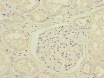 Immunohistochemistry of paraffin-embedded human kidney tissue using DCTN6 Antibody at dilution of 1:100Rabbit anti-Human DCTN6 Polyclonal Antibody