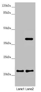 Western blot | All lanes: DCTN6 antibody at 3.5 μg/ml | Lane 1: A549 whole cell lysate | Lane 2: U251 whole cell lysate | Secondary | Goat polyclonal to rabbit IgG at 1/10000 dilution | Predicted band size: 21 kDa | Observed band size: 21, 40 kDaRabbit anti-Human DCTN6 Polyclonal Antibody