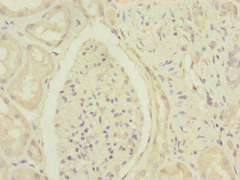 Immunohistochemistry of paraffin-embedded human kidney tissue using DCTN6 Antibody at dilution of 1:100Rabbit anti-Human DCTN6 Polyclonal Antibody